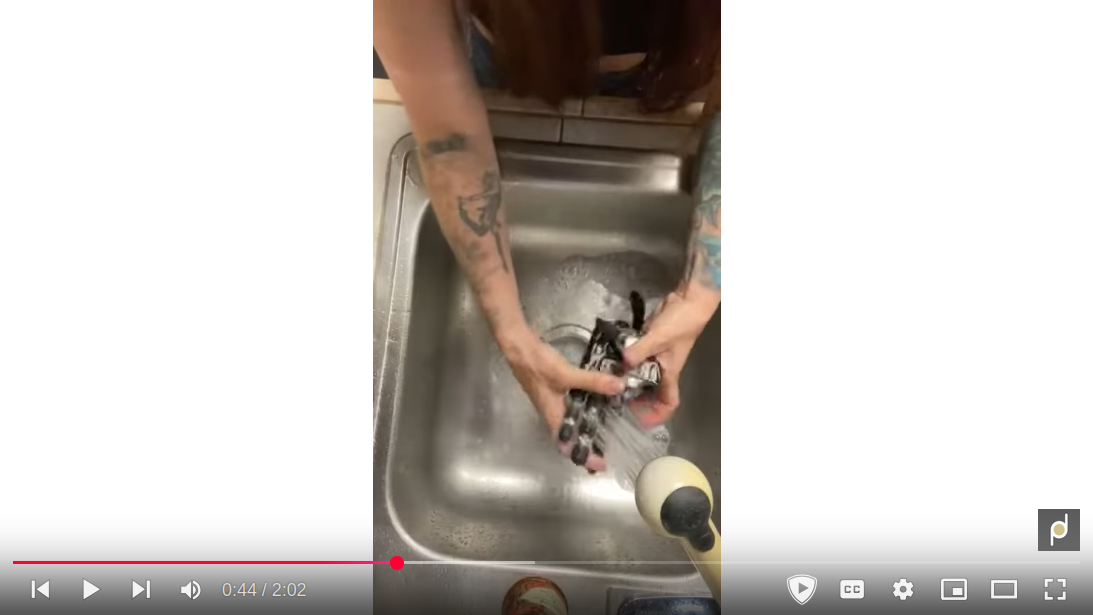 Point Designs Patient Angie Lott Washing Titanium Prosthetic Fingers