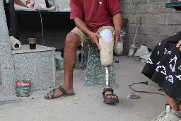 Precious Plastic Prosthetics